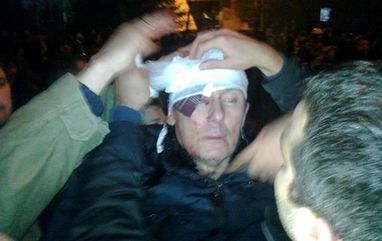 Луценко потрапив до реанімації - 10 ударів по голові, Руслана постраждала від сльозогінного газу (ФОТО, ВІДЕО)
