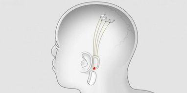 Илон Маск предлагает транслировать музыку прямо в мозг (фото)
